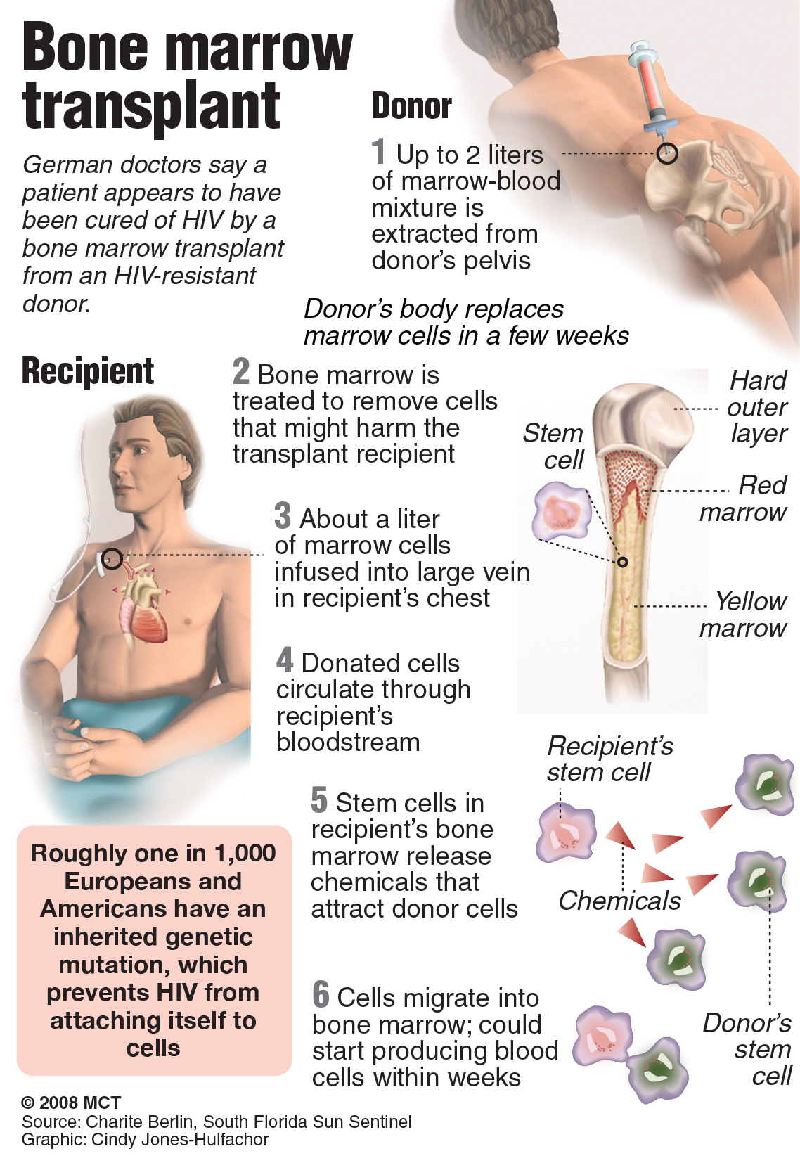 5th Man Cured Of Hiv After Stem Cell Transplant